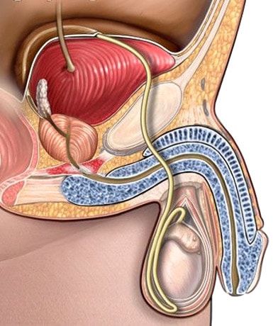 Laser Prostate Surgery