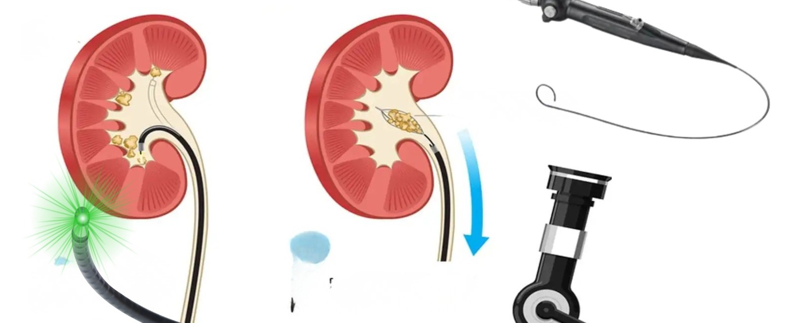 Reconstructive Uro-Surgery
